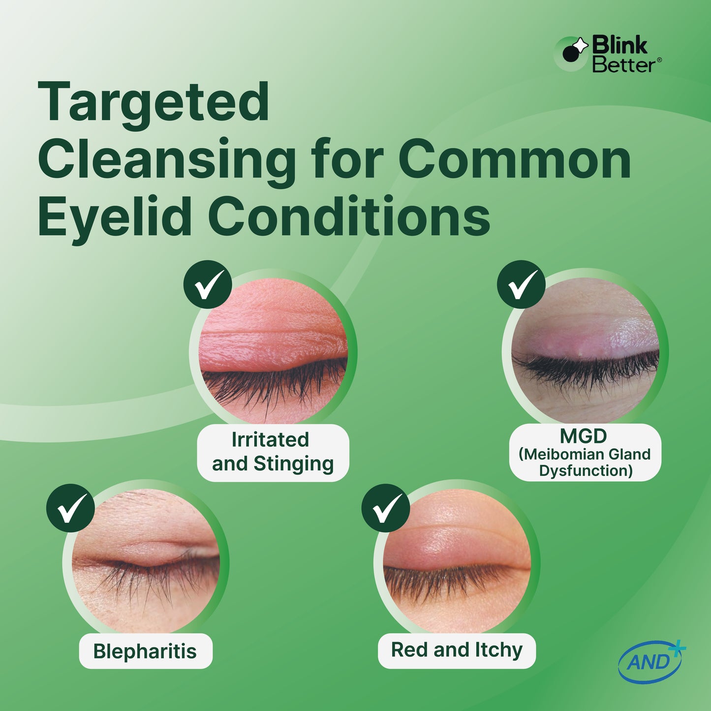 BetterLids Eyelid Cleansing Gel - Tea Tree Oil Daily Cleanser