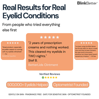 BetterLids Self-Heating Eye Mask - 30 Pack for Blepharitis, MGD, Styes & Puffy Eyes | Warm Compress Therapy