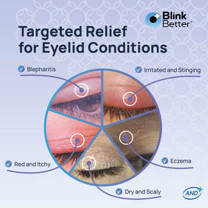 BetterLids Eyelid Ointment - Overnight Relief for Dry, Flaky Skin